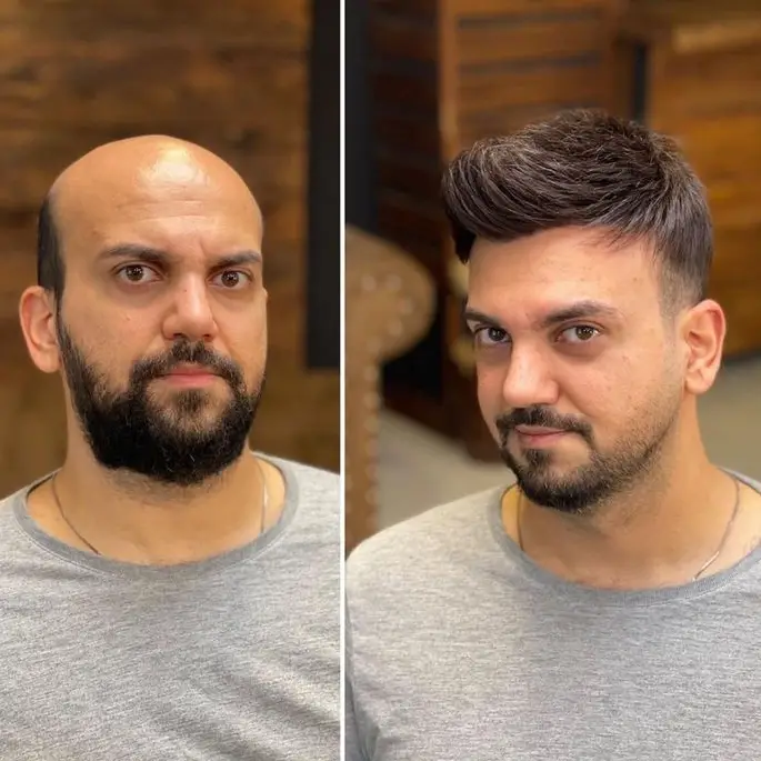 0.03mm Ultra Thin Skin V-looped man with toupee pu0311 - Image 4