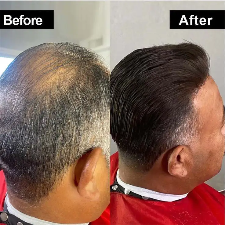 FFLE | Full French Lace Hairpieces for Men - Image 7