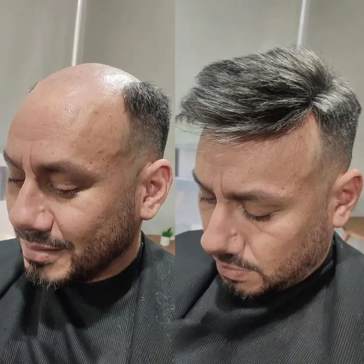 FFP | French Lace with Thin Skin Hairpieces for Thinning Hair - Image 5