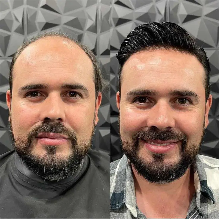 FFLE | Full French Lace Hairpieces for Men - Image 5