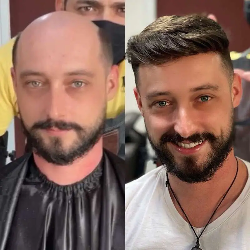 0.03mm Ultra Thin Skin V-looped man with toupee pu0311 - Image 5