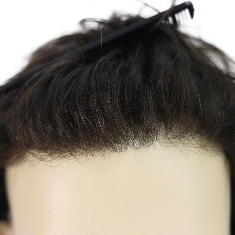 0.03mm Three Thin Skin Men's Hair Systems - Image 2
