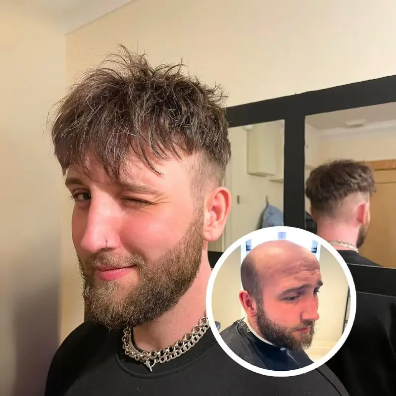 0.03mm Ultra Thin Skin V-looped man with toupee pu0311 - Image 7