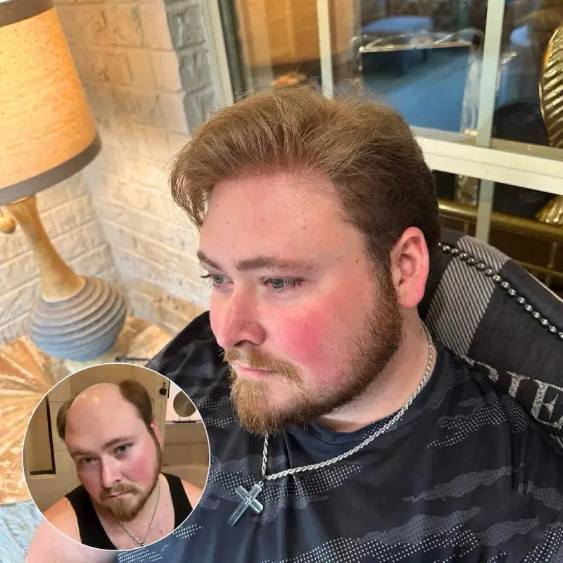 0.06mm Ultra Thin Skin V-looped toupee for men's hair p0677 - Image 7