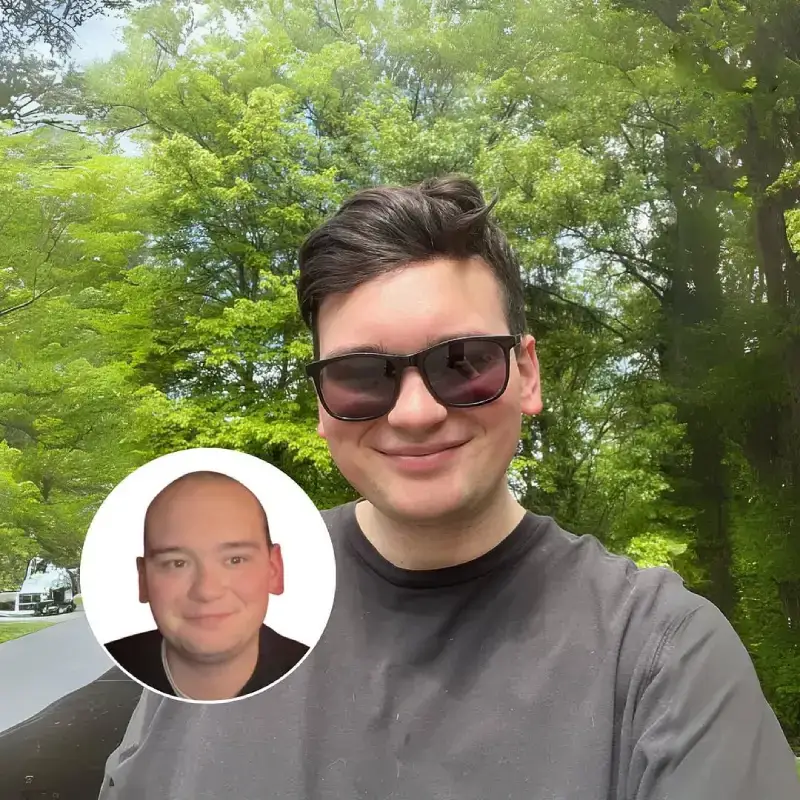 0.06mm Ultra Thin Skin V-looped toupee for men's hair p0677 - Image 5